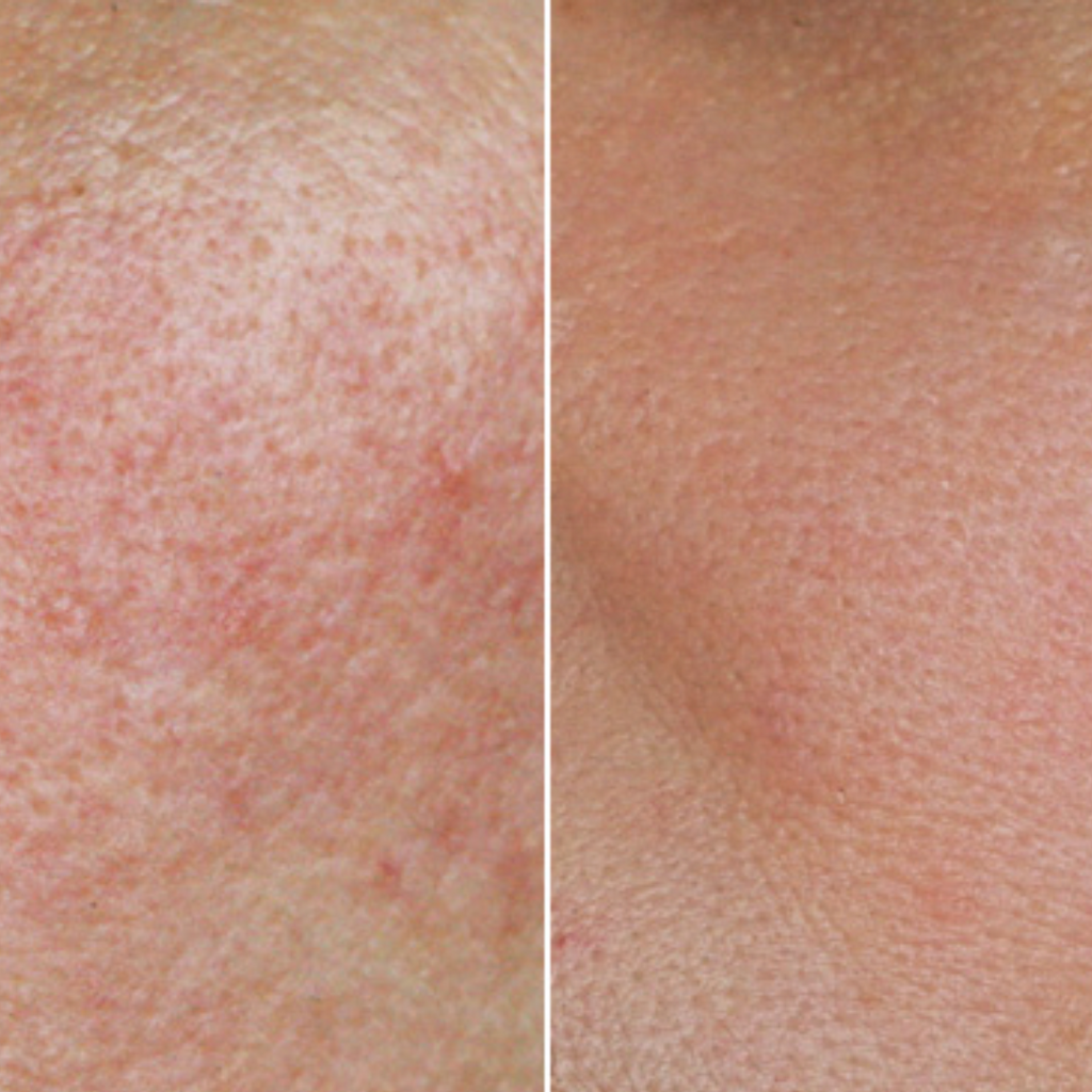 Fau Skin Solution SOS Ampoule